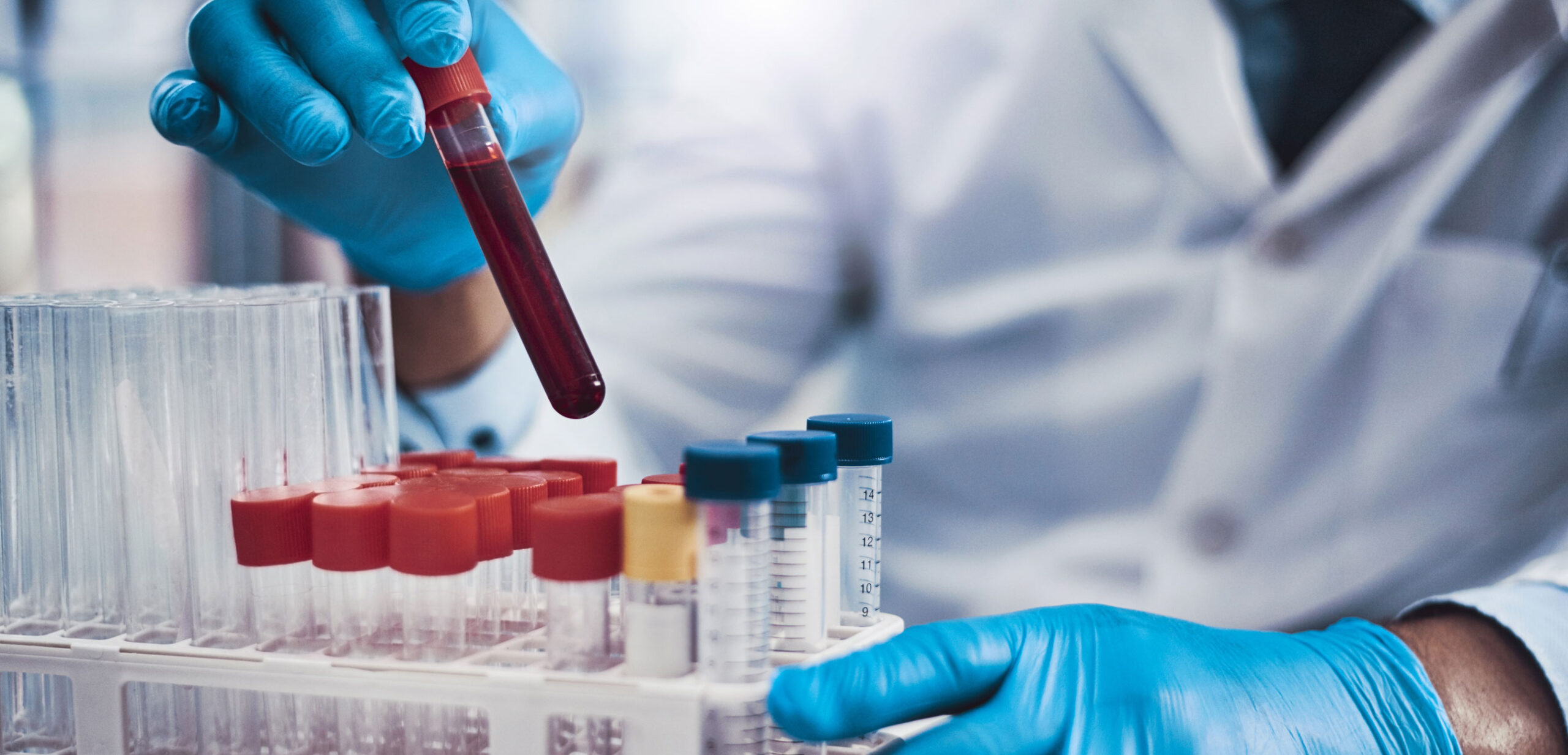 Clinical Trial Prescreening